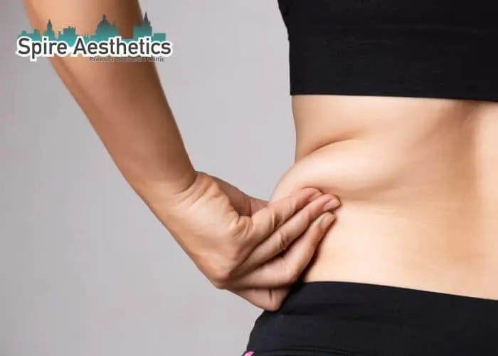 Image of woman pinching fat on their hips St Helens. Fat Freezing treatment