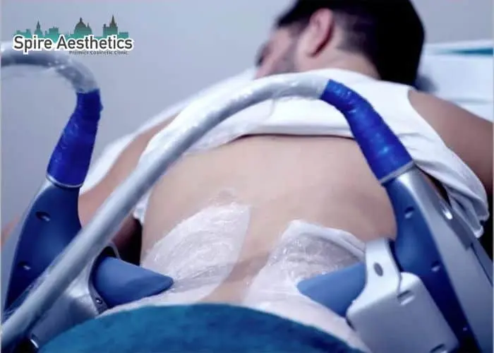 Man having fat freezing treatment done on love handles before a competitions St Helens to create a sculpted look.