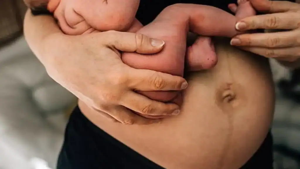 Why Is My Stomach Still Big After Pregnancy St Helens?